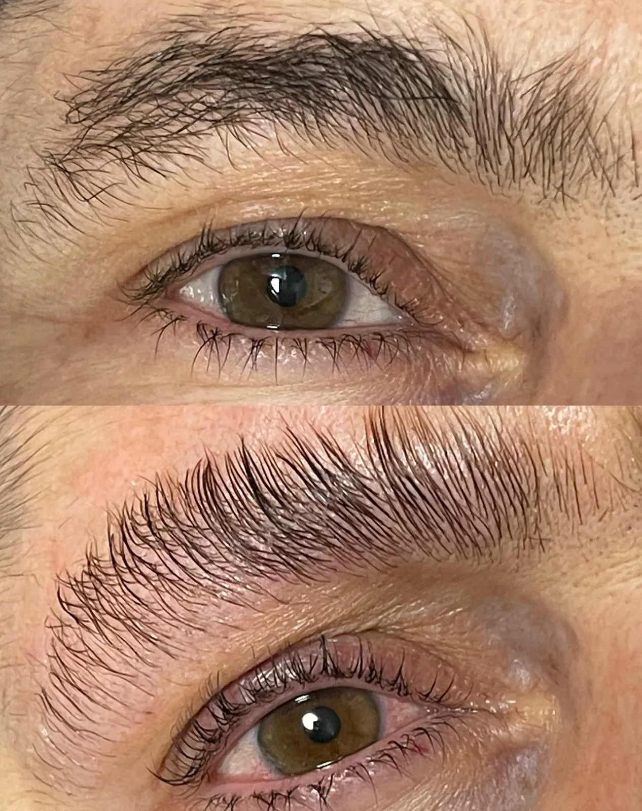 Hautbild vor und nach einer Behandlung, Kundin liegend